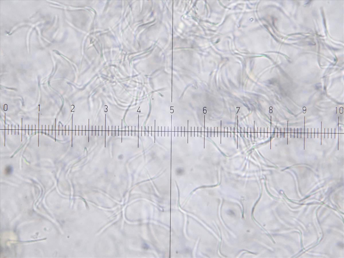 Fellhaneropsis myrtillicola (door Tom Schrier)