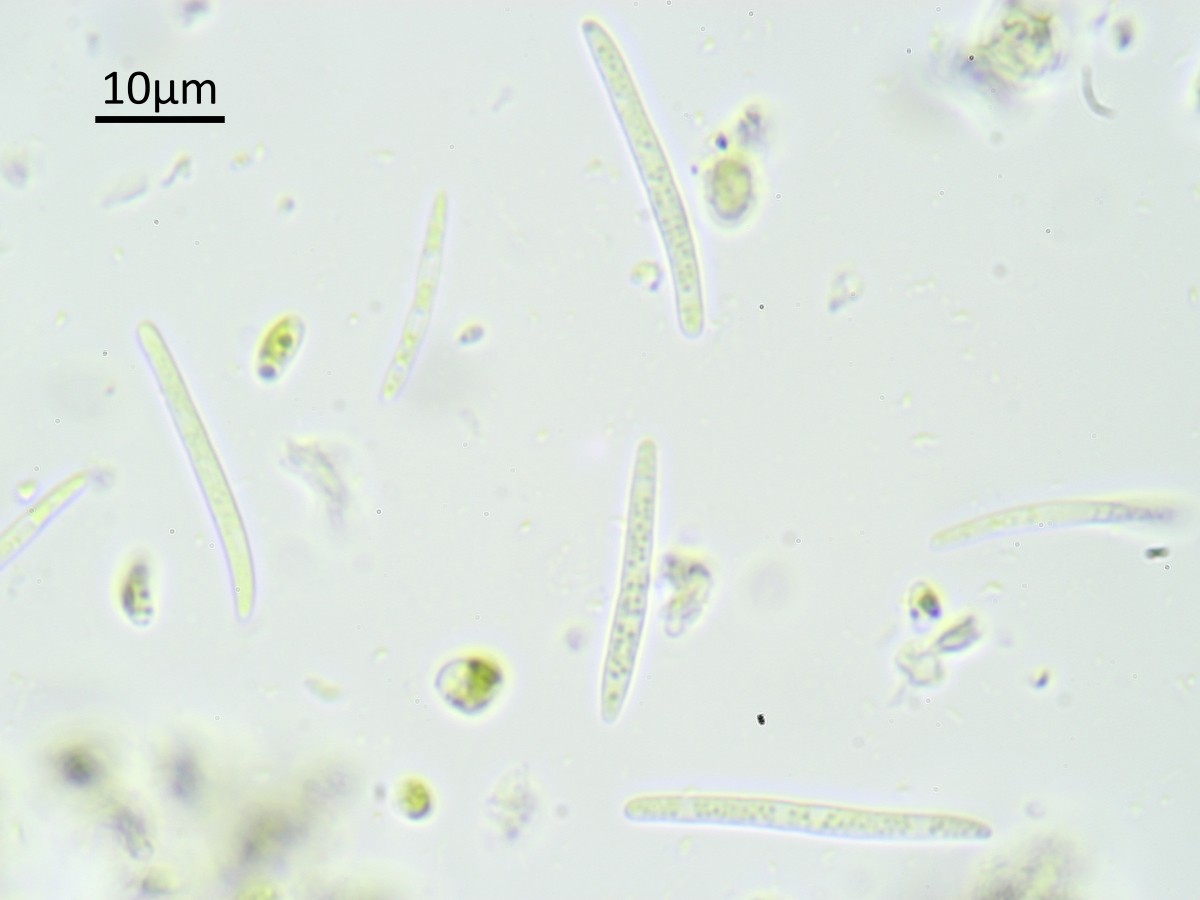 Bacidia circumspecta (door Henk-Jan van der Kolk)