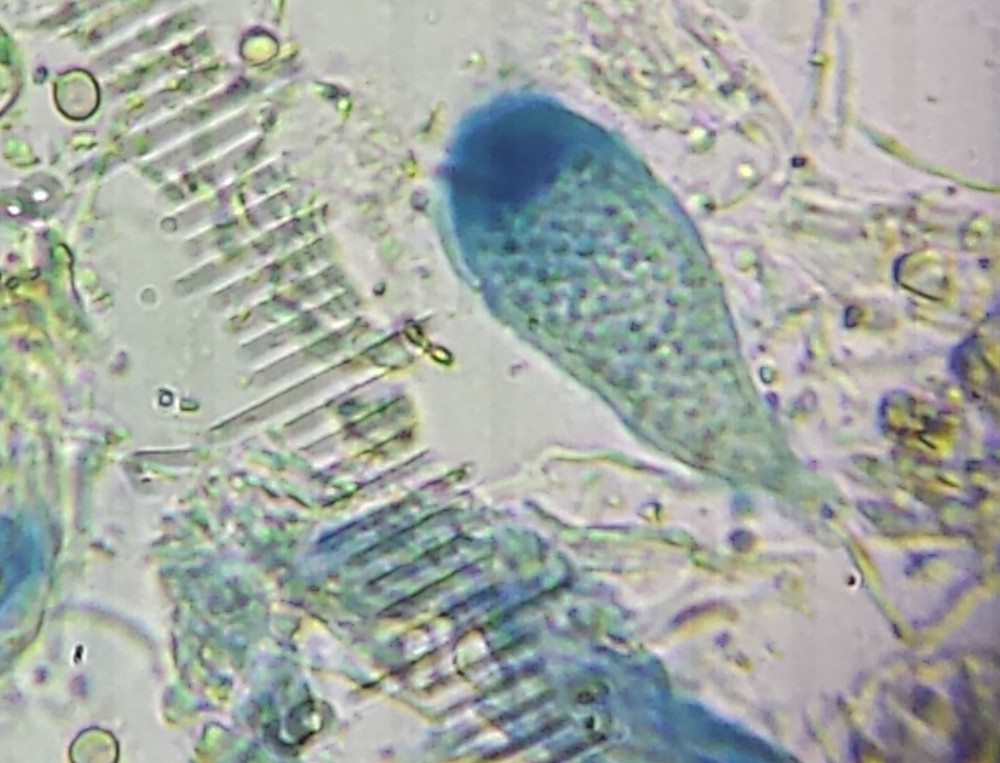 Biatorella flavella (door Bart Hessen)