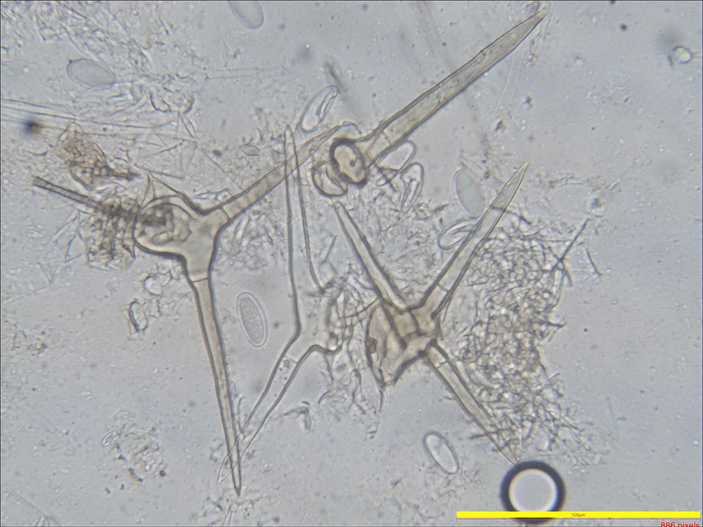 Cheilymenia stercorea (door Laurens van Run)