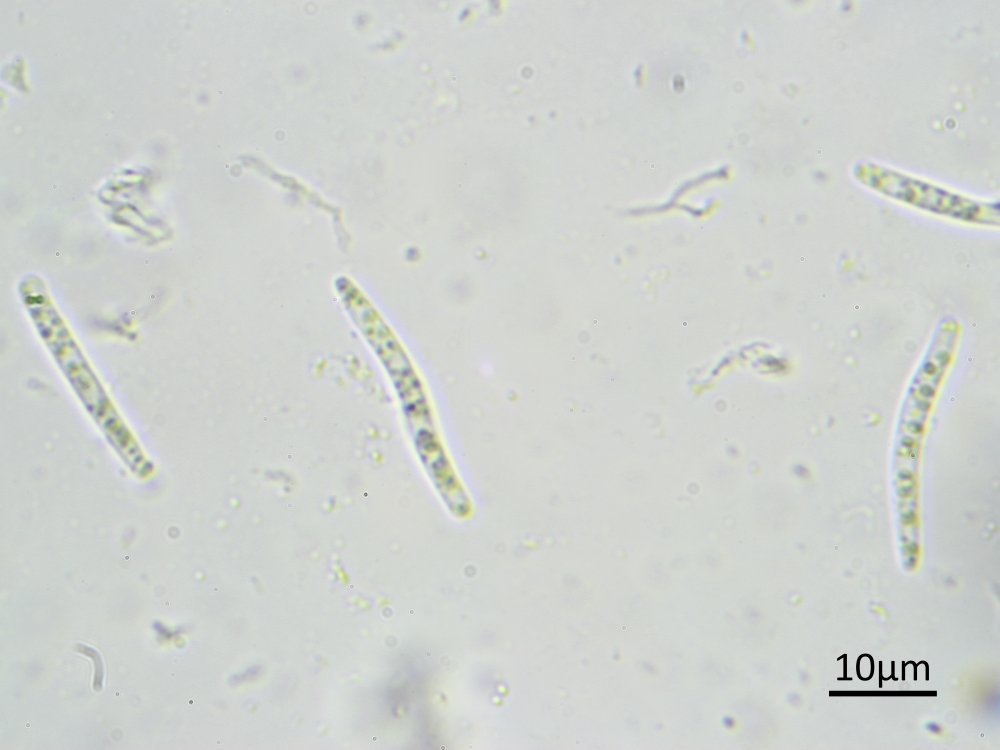 Cryptodiscus cladoniicola (door Henk-Jan van der Kolk)
