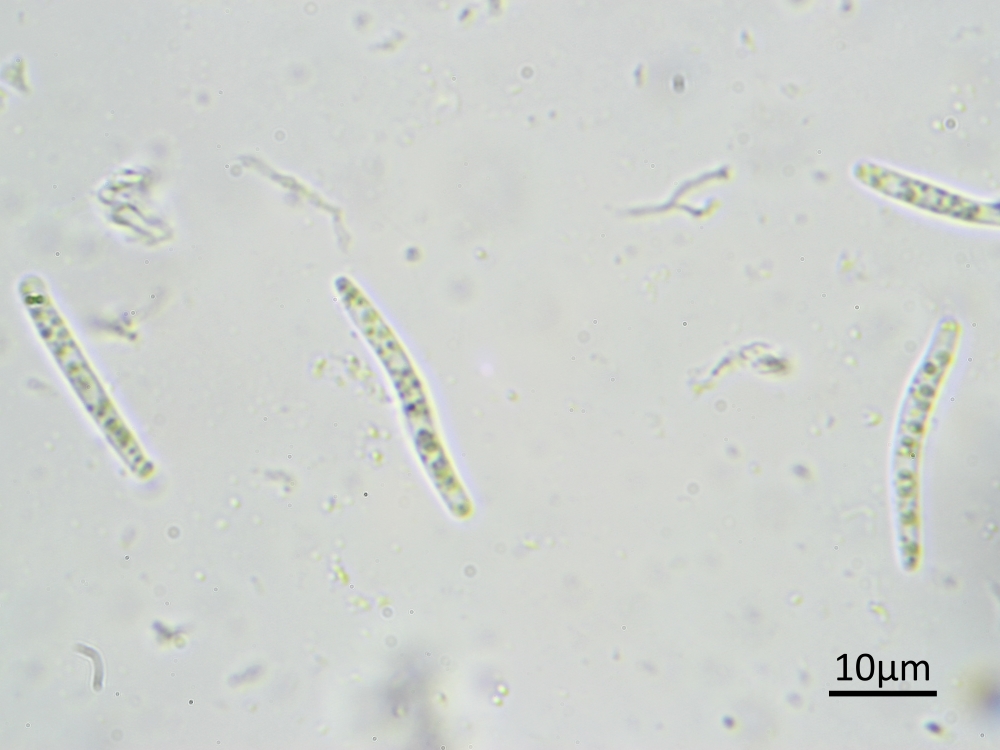 Cryptodiscus cladoniicola (door Henk-Jan van der Kolk)