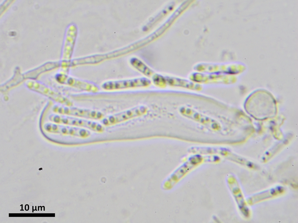 Epigloea bactrospora (door Henk-Jan van der Kolk)