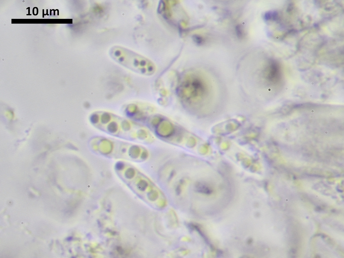 Epigloea pleiospora (door Henk-Jan van der Kolk)