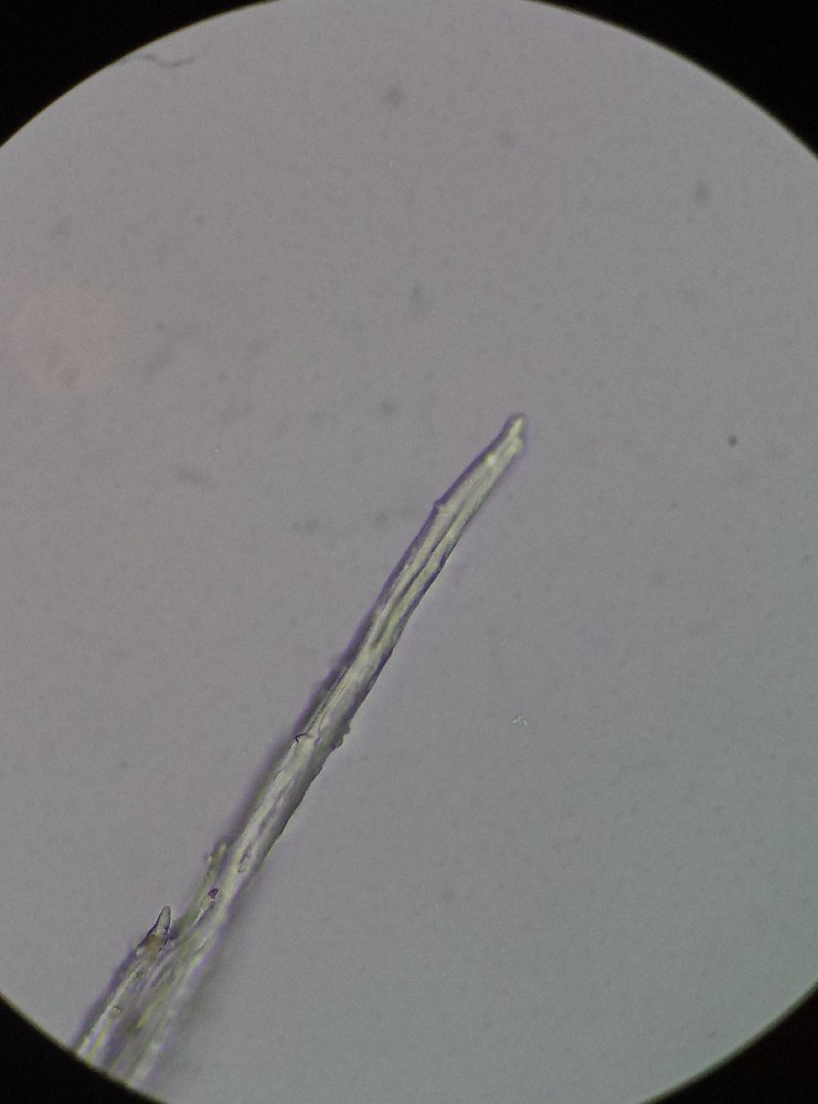 Hedwigia stellata (door Rens van der Knoop)