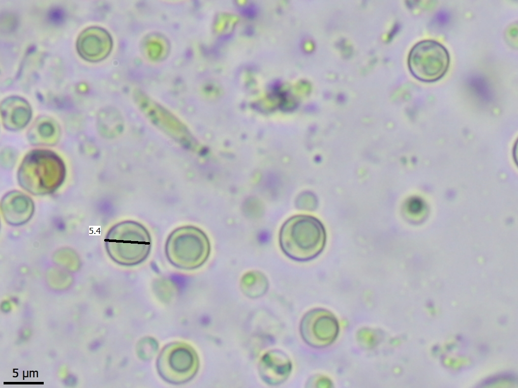 Thelocarpon opertum (door Lukas Verboom)