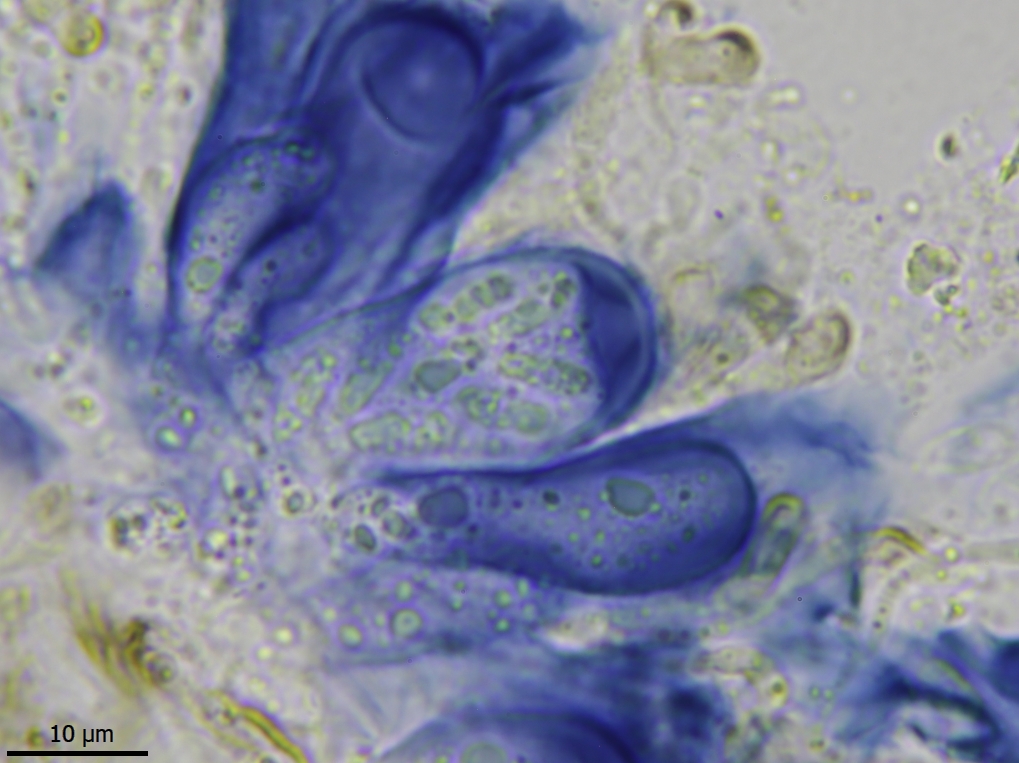 Protoparmelia ochrococca (door Lukas Verboom)