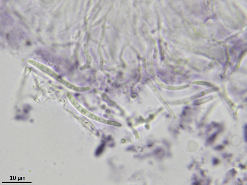 Micarea longispora (door Lukas Verboom)