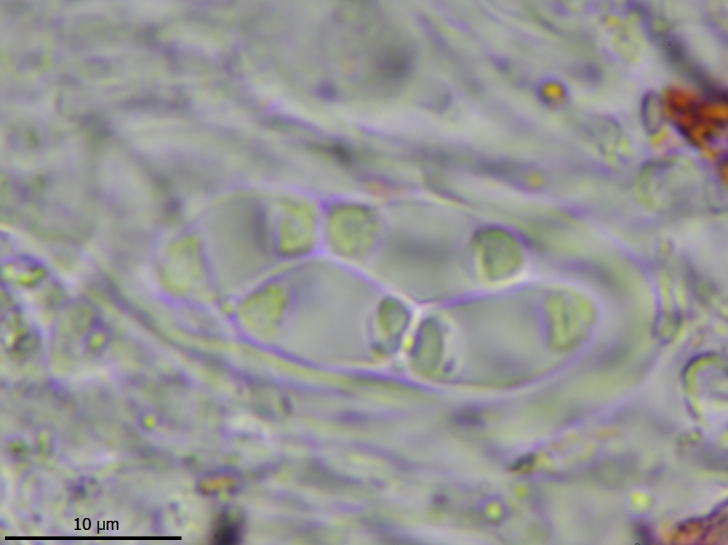Flavoplaca flavocitrina (door Lukas Verboom)