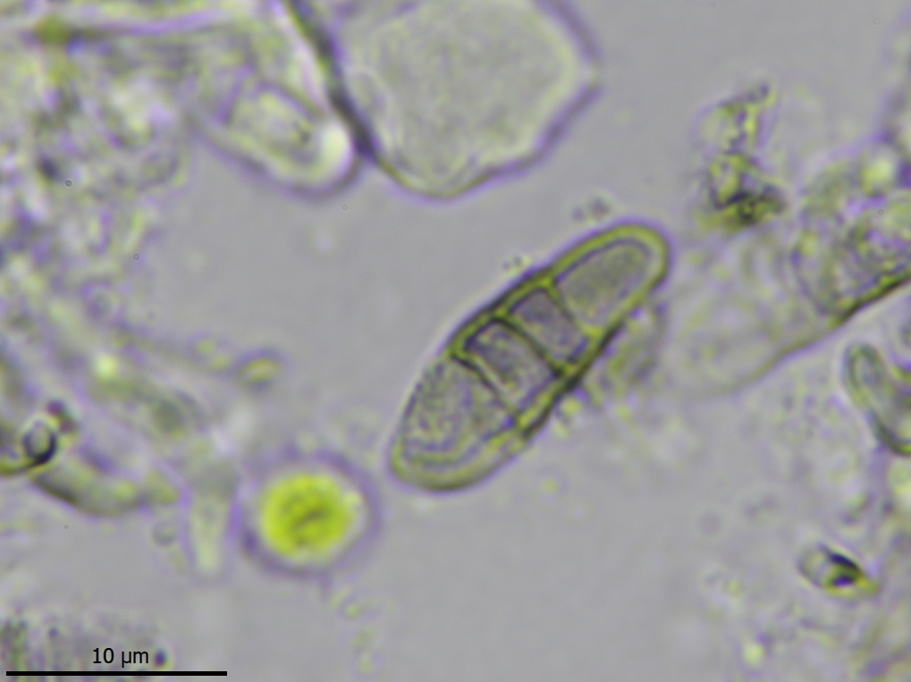 Reichlingia anombrophila (door Lukas Verboom)