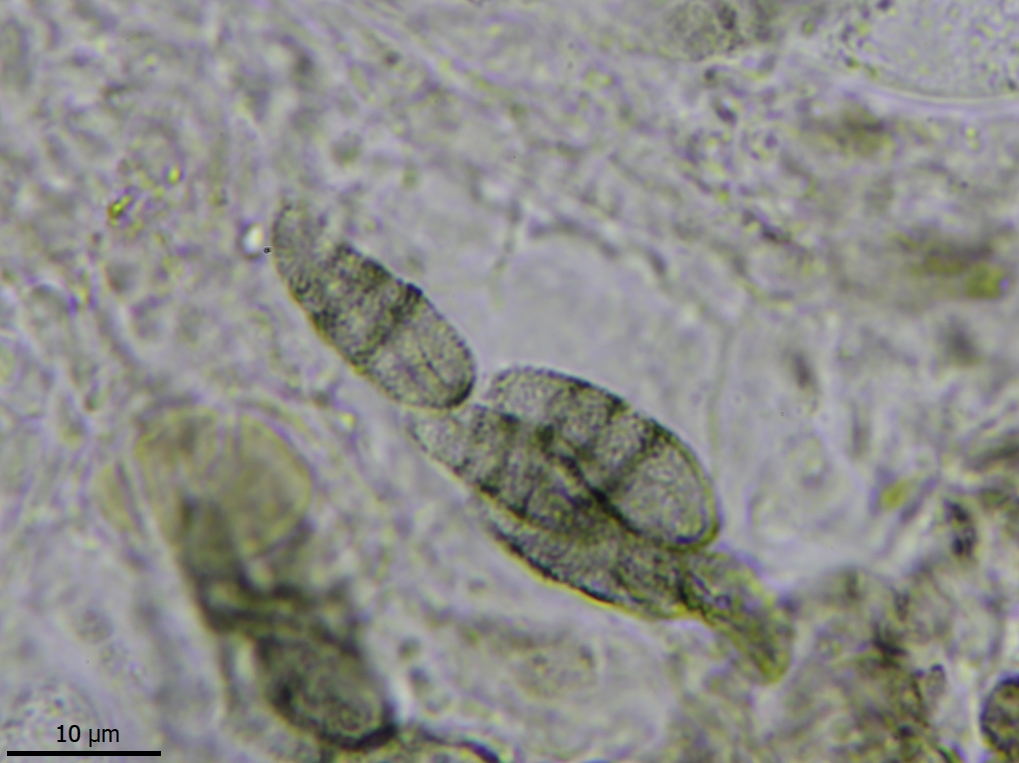 Reichlingia anombrophila (door Lukas Verboom)