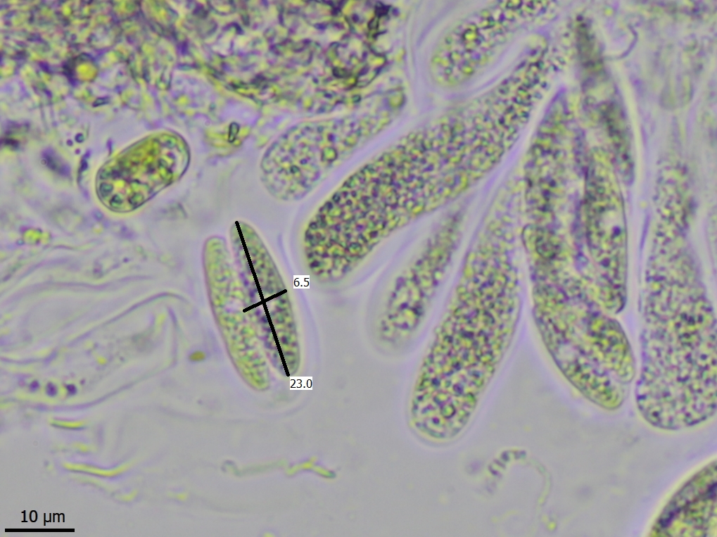 Verrucaria bryoctona (door Lukas Verboom)