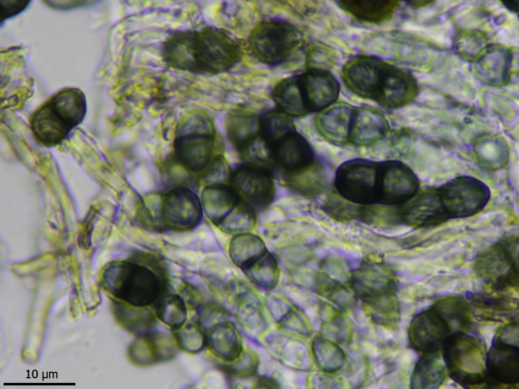 Cyphelium sessile (door Lukas Verboom)
