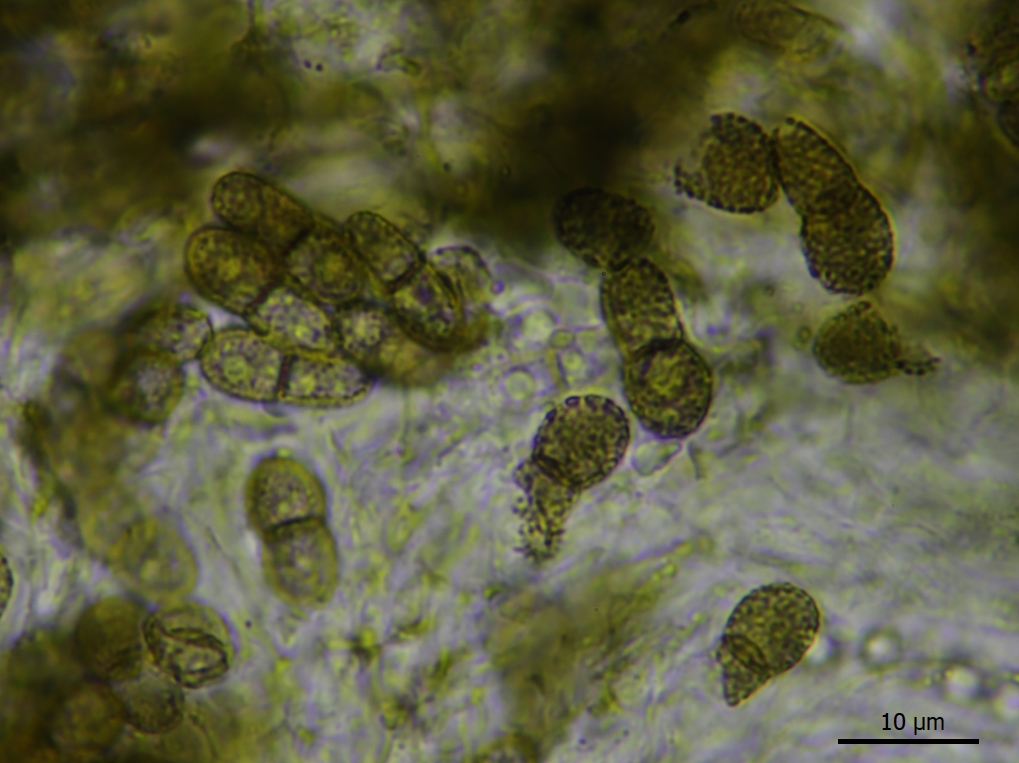 Abrothallus bertianus (door Lukas Verboom)