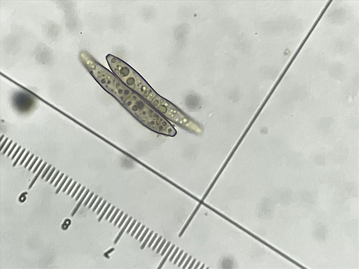 Fusoidiella depressa (door Eduard Osieck)