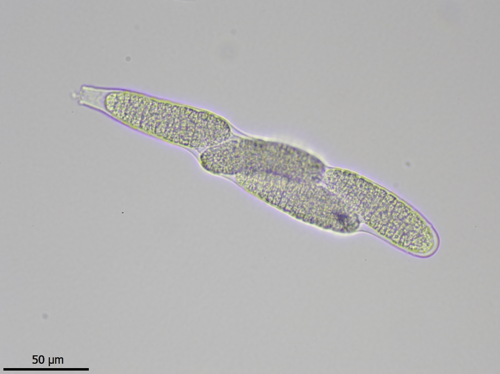 Thelenella muscorum (door Lukas Verboom)