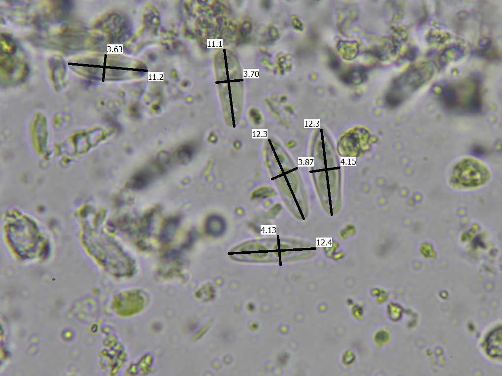 Lecanora strobilina (door Lukas Verboom)