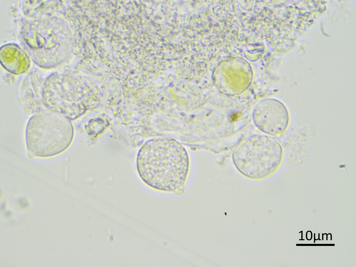 Laetisaria lichenicola (door Henk-Jan van der Kolk)