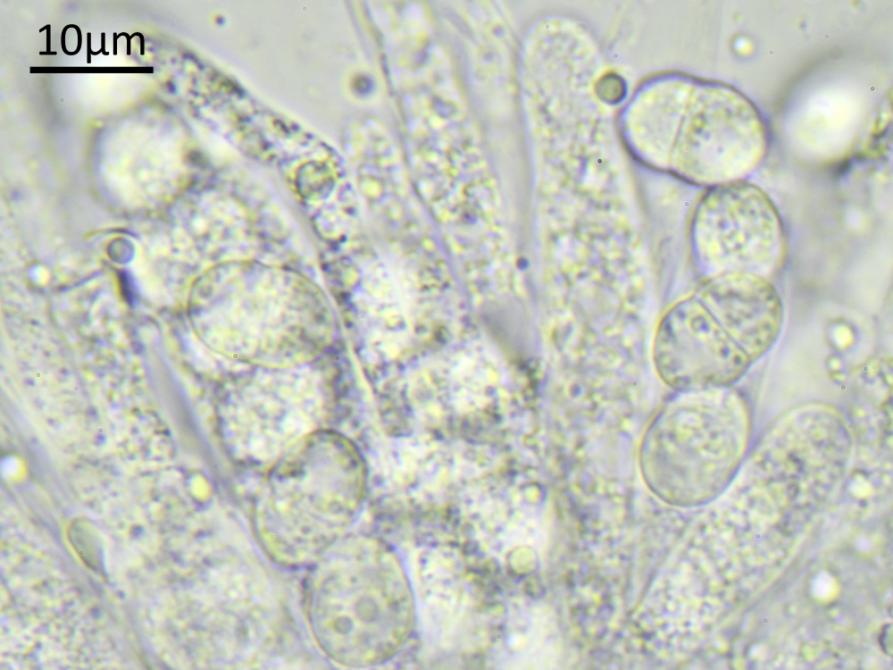 Lichenochora physciicola (door Henk-Jan van der Kolk)