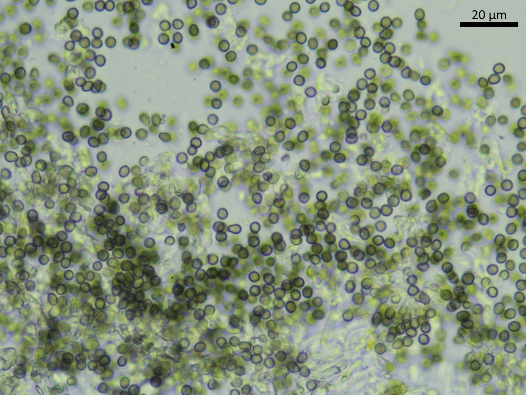 Lichenoconium xanthoriae (door Henk-Jan van der Kolk)