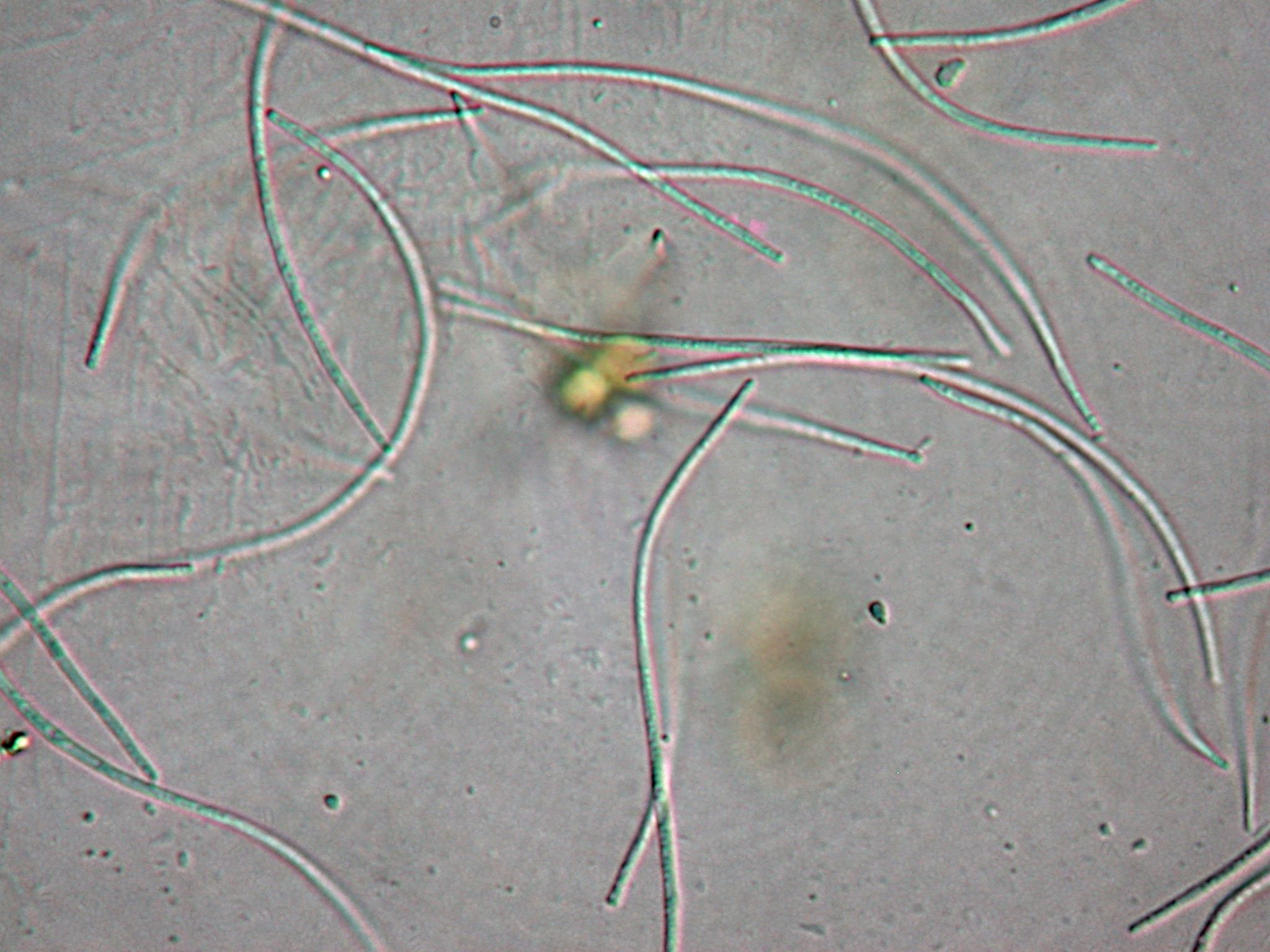 Micarea subcinerea (door André Aptroot)