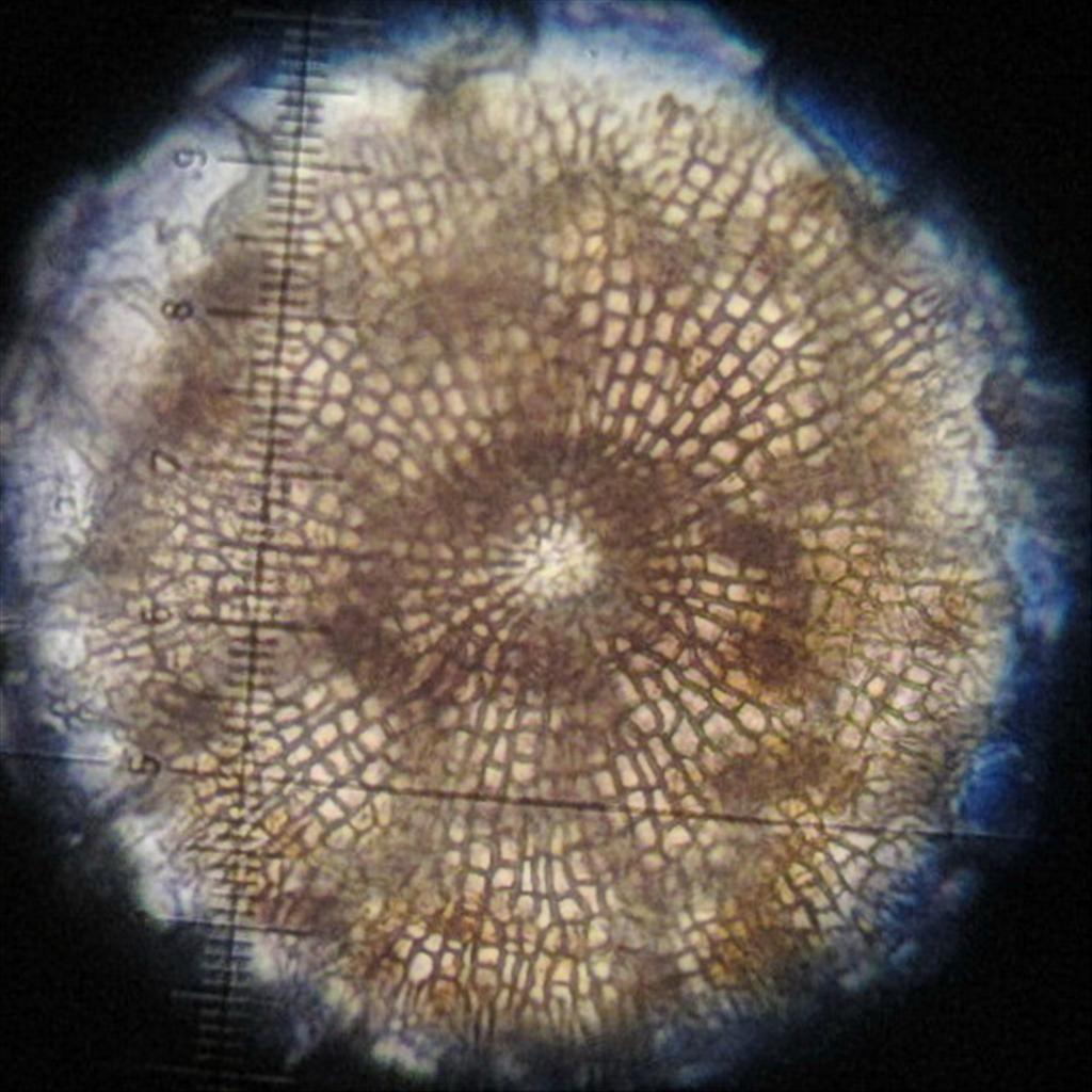 Microthyrium ciliatum (door Eduard Osieck)