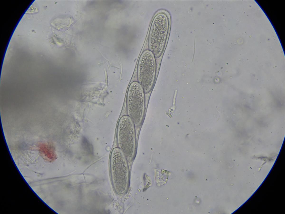 Pertusaria leioplaca (door Lukas Verboom)