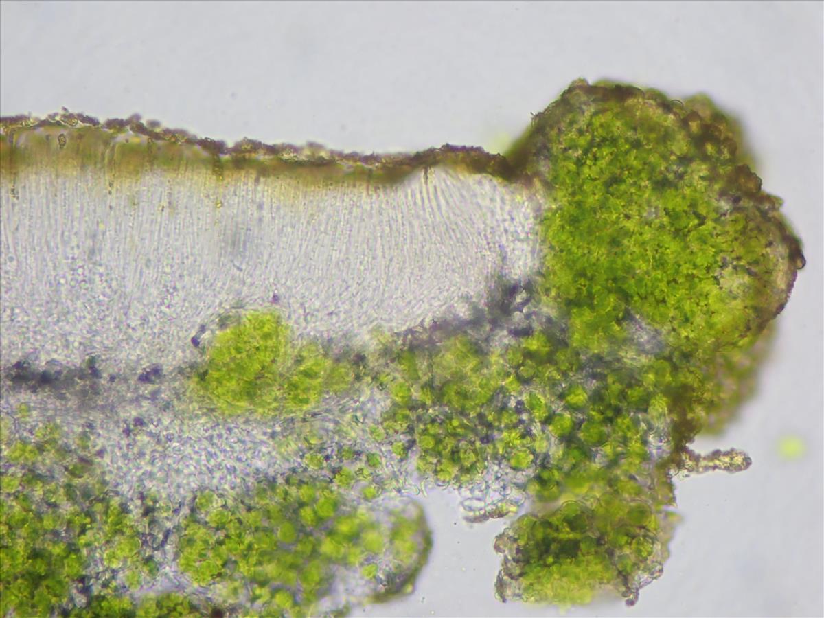 Candelariella xanthostigma (door Lukas Verboom)