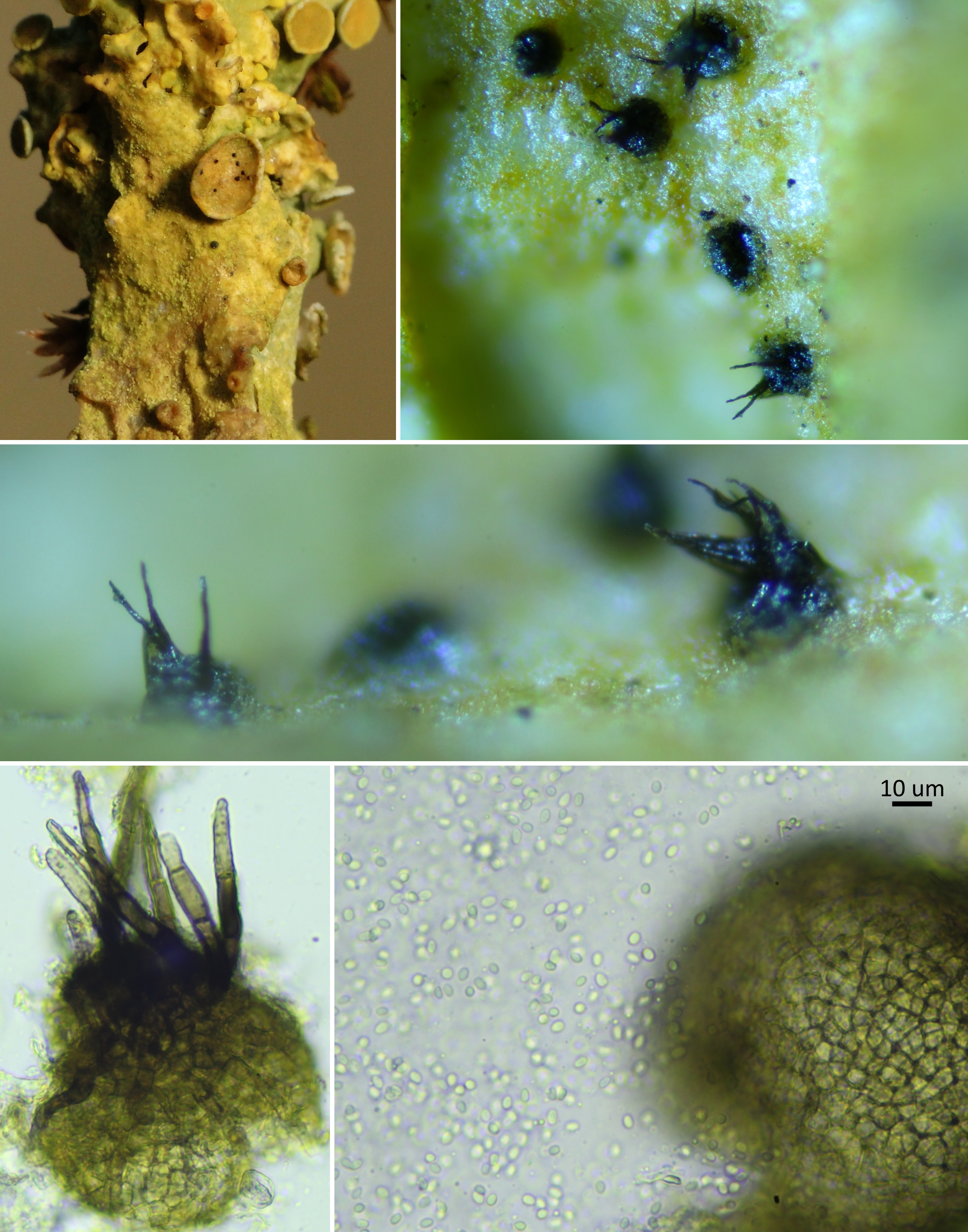 Pyrenochaeta xanthoriae (door Henk-Jan van der Kolk)