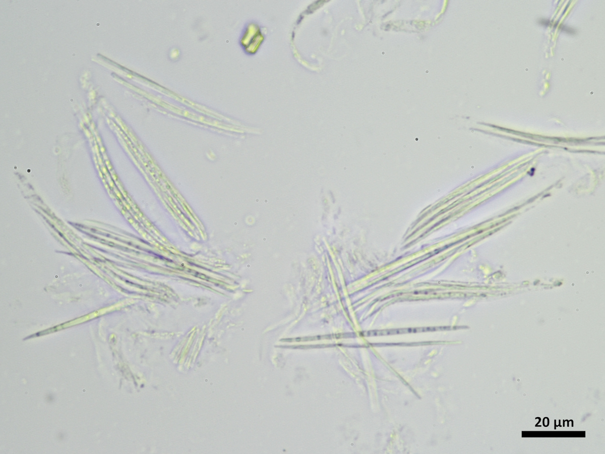 Sarcopyrenia beckhausiana (door Henk-Jan van der Kolk)