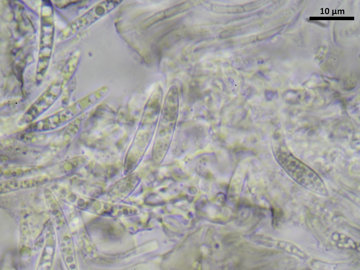 Scoliciosporum gallurae (door Henk-Jan van der Kolk)