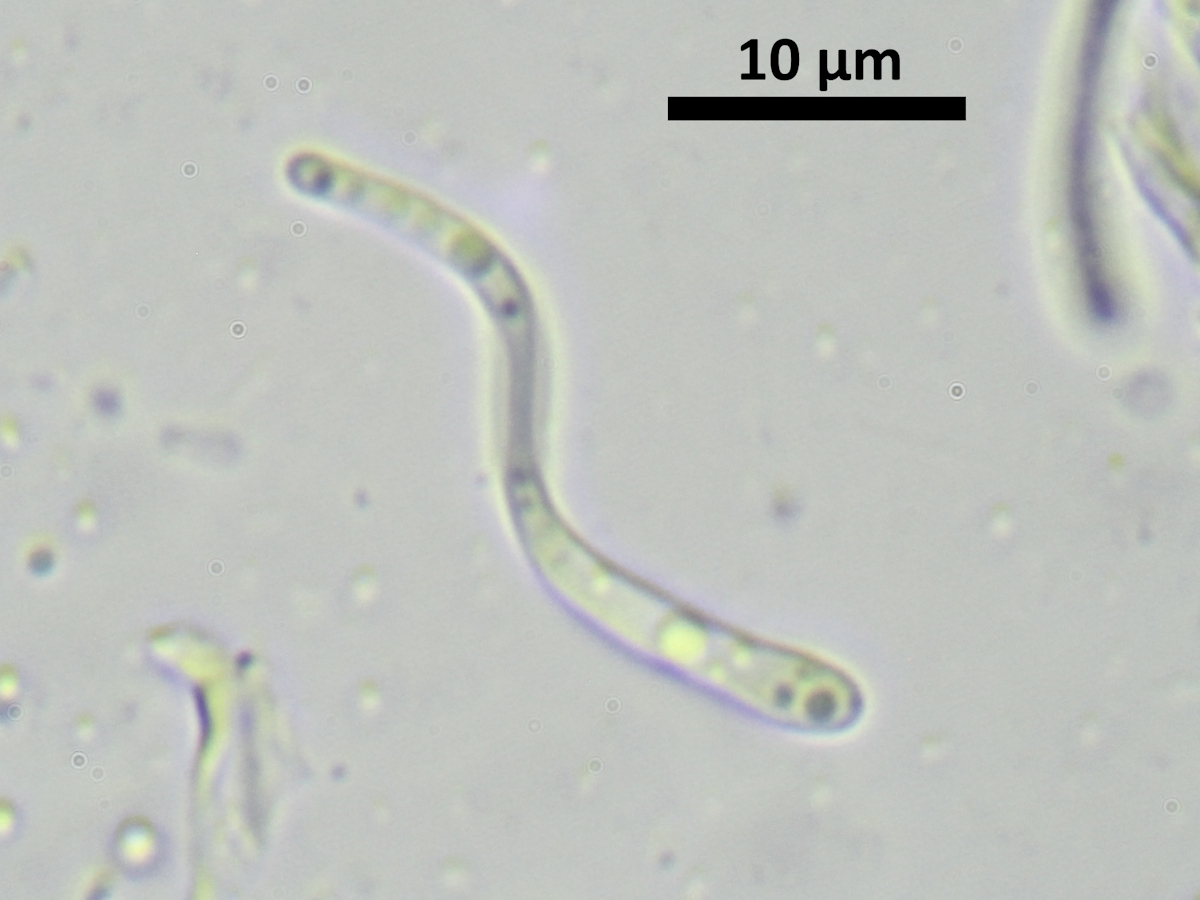Scoliciosporum sarothamni (door Henk-Jan van der Kolk)