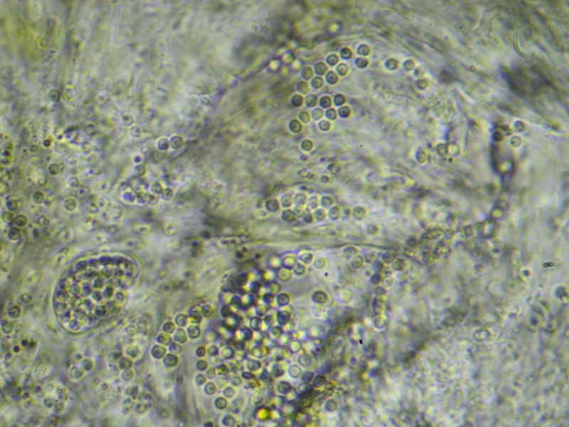 Strangospora deplanata (door Henk-Jan van der Kolk)