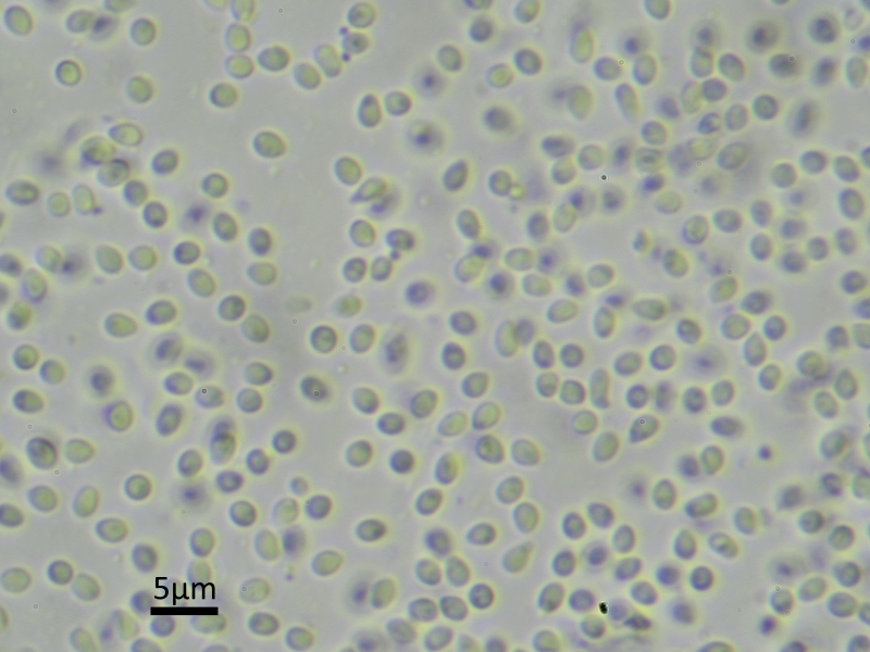 Strangospora deplanata (door Henk-Jan van der Kolk)