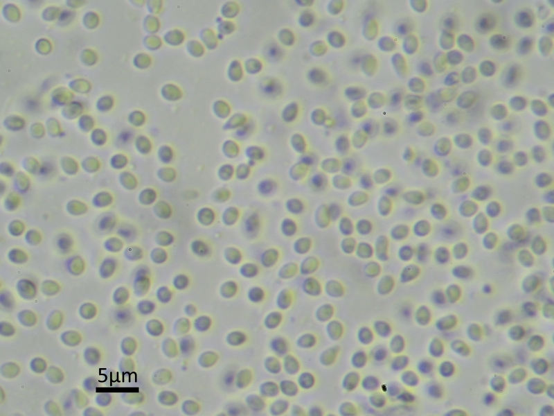 Strangospora deplanata (door Henk-Jan van der Kolk)