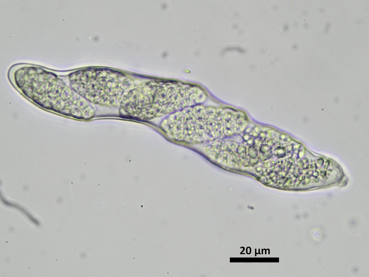 Thelenella modesta (door Henk-Jan van der Kolk)