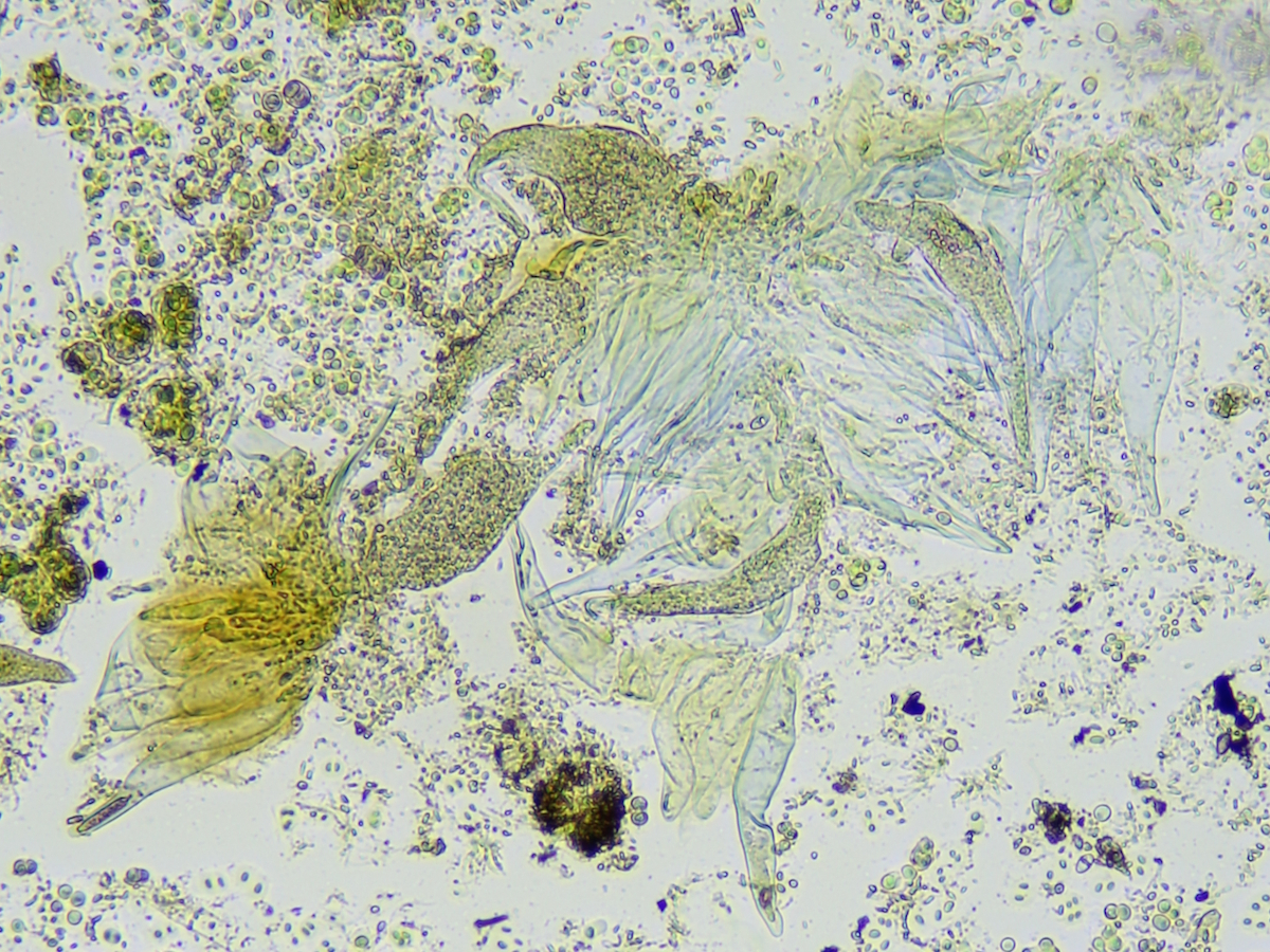 Thelocarpon intermediellum (door Henk-Jan van der Kolk)