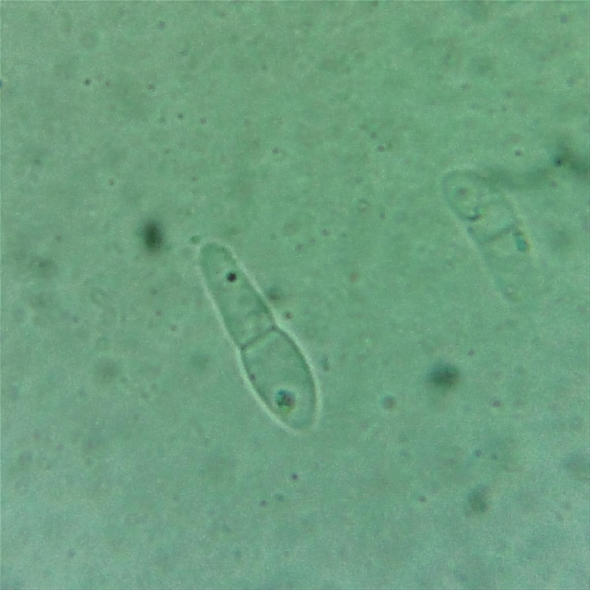 Trichonectria anisospora (door Henk-Jan van der Kolk)