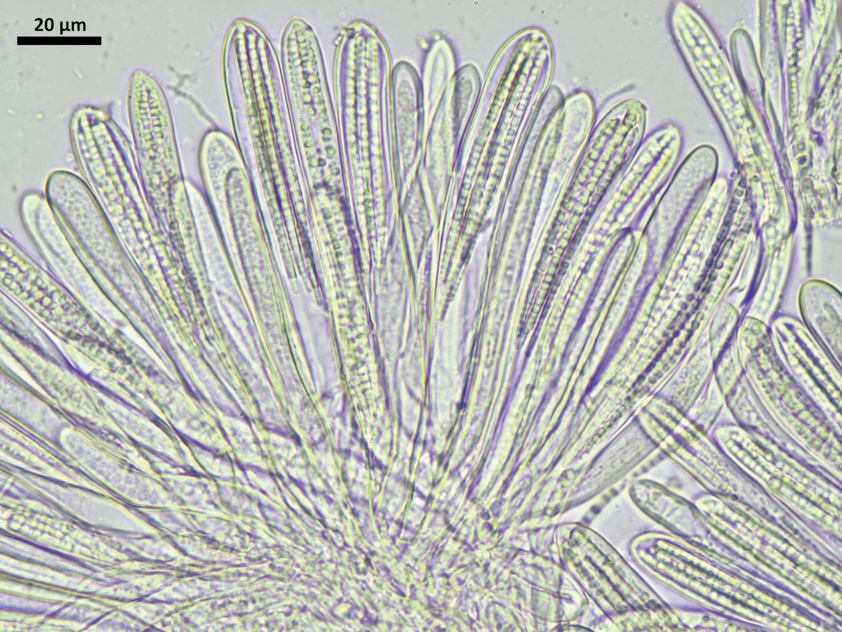 Vezdaea acicularis (door Henk-Jan van der Kolk)