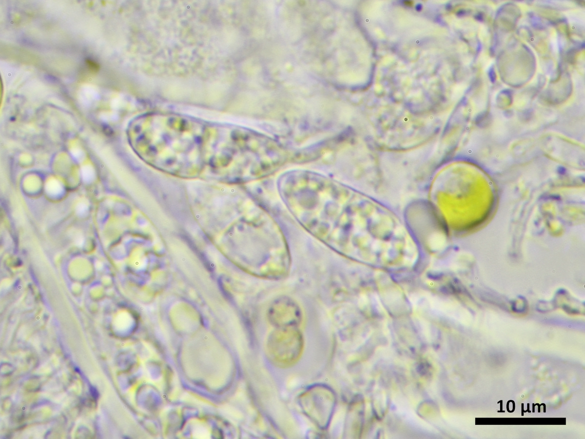 Vezdaea aestivalis (door Henk-Jan van der Kolk)