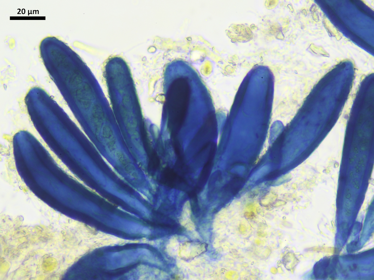 Vezdaea cobria (door Tom Schrier)