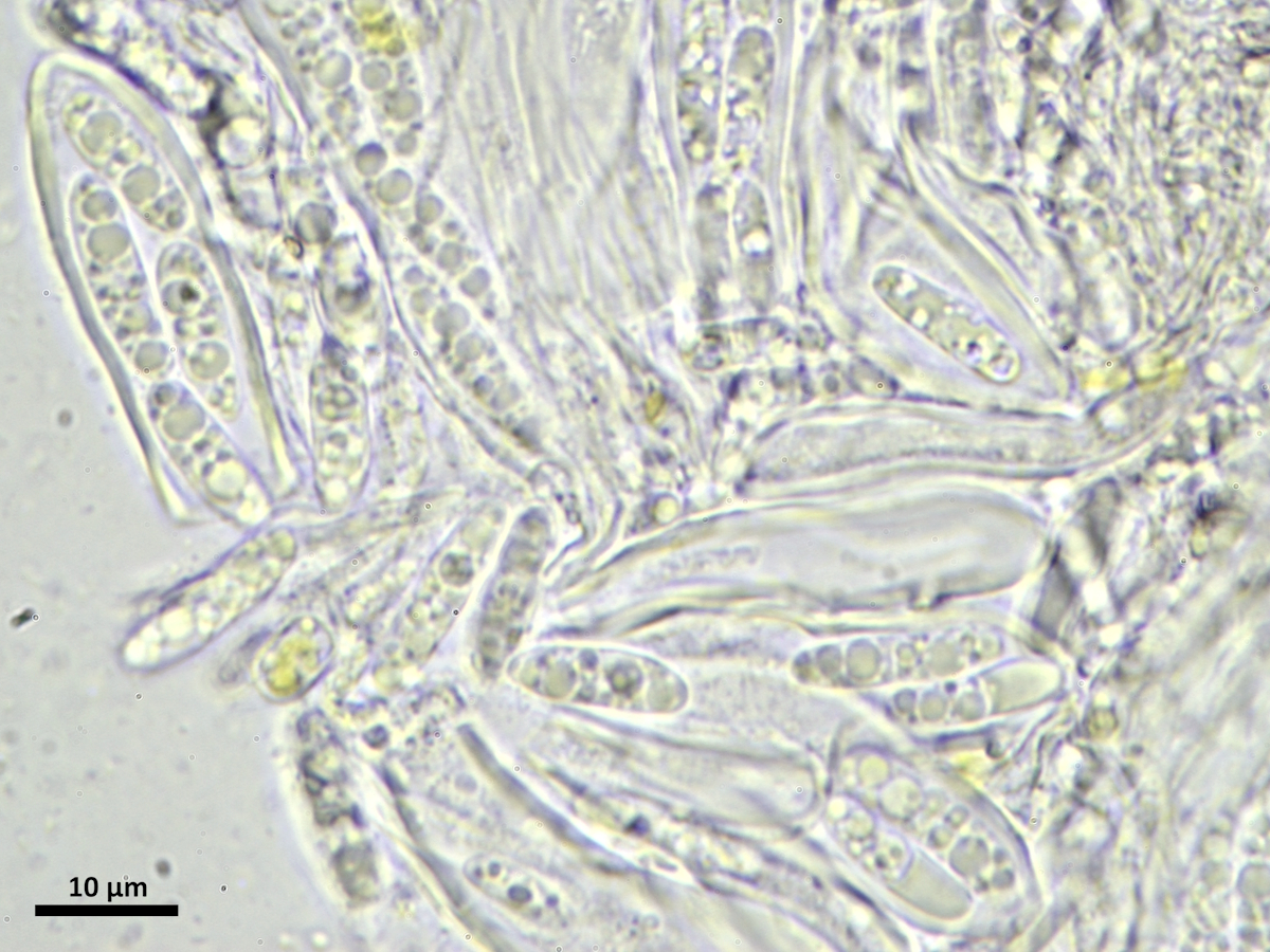 Vezdaea leprosa (door Henk-Jan van der Kolk)