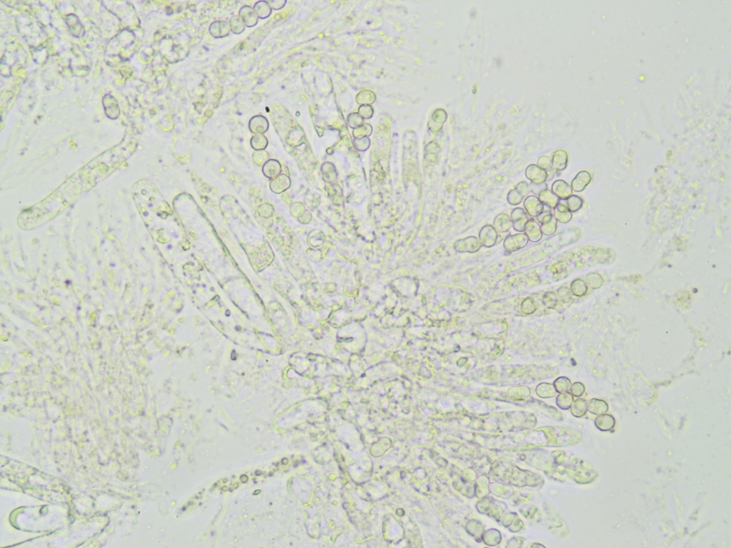 Xenonectriella subimperspicua (door Henk-Jan van der Kolk)