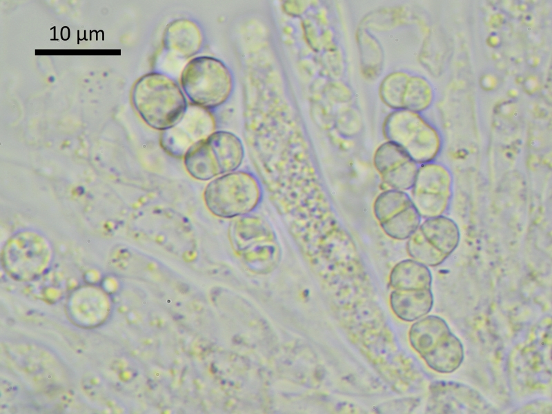 Xenonectriella subimperspicua (door Henk-Jan van der Kolk)