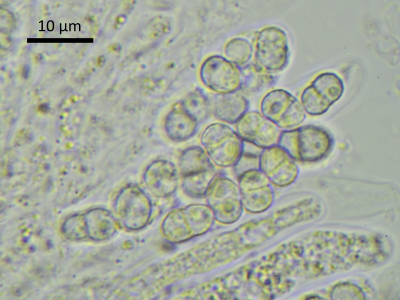 Xenonectriella subimperspicua (door Henk-Jan van der Kolk)