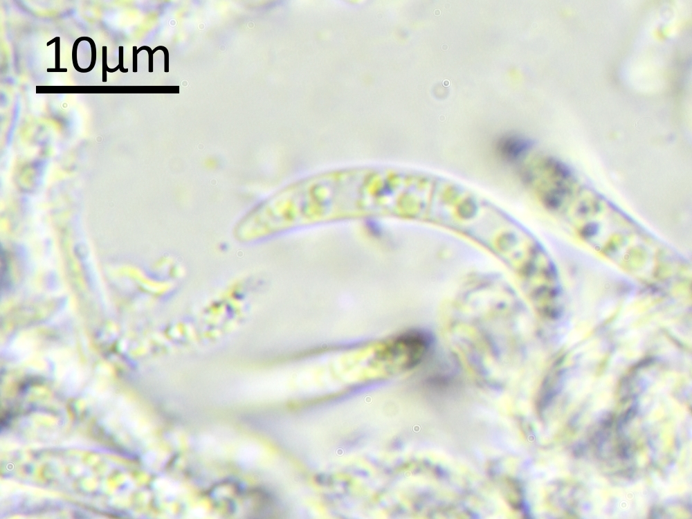 Leptorhaphis epidermidis (door Henk-Jan van der Kolk)