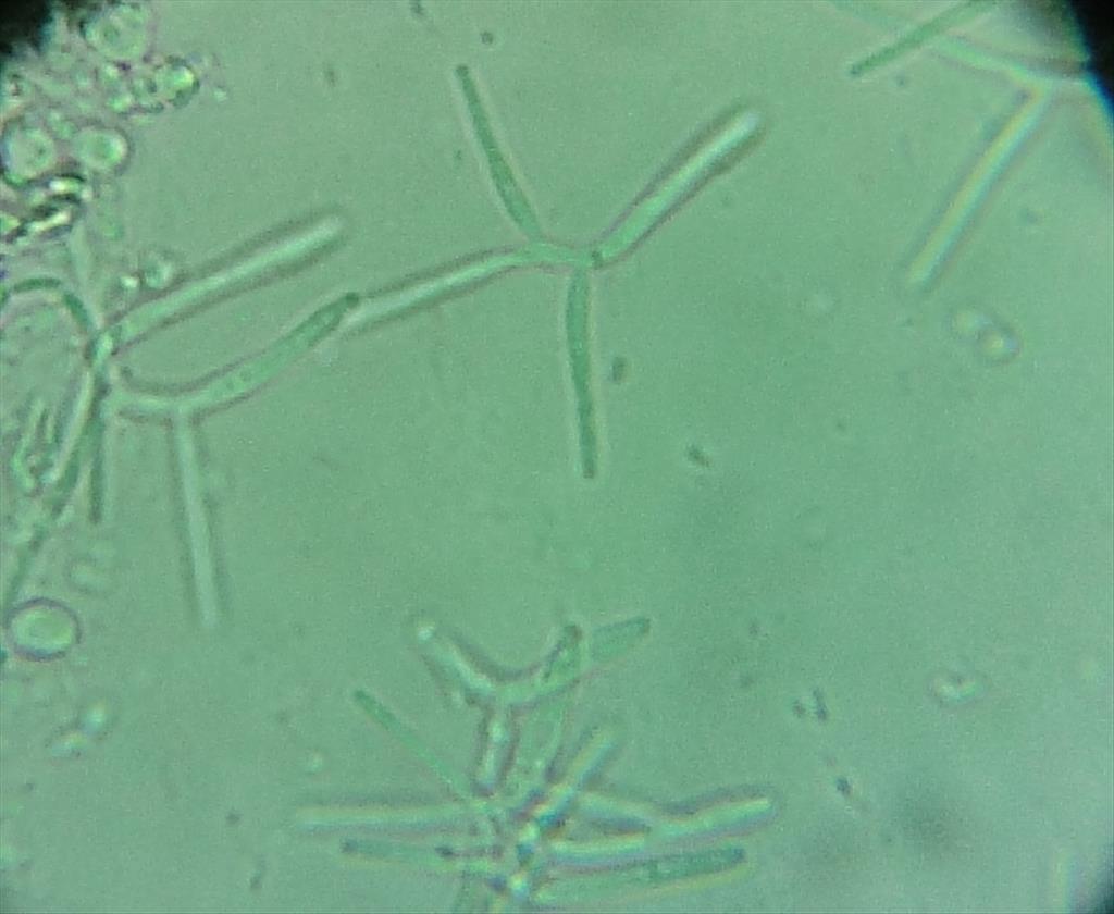 Cladoniicola staurospora (door Henk-Jan van der Kolk)