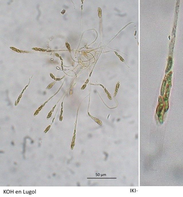 Cryptosphaeria ligniota (door Laurens van der Linde)
