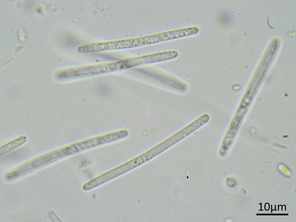 Sarcopyrenia cylindrospora (door Henk-Jan van der Kolk)