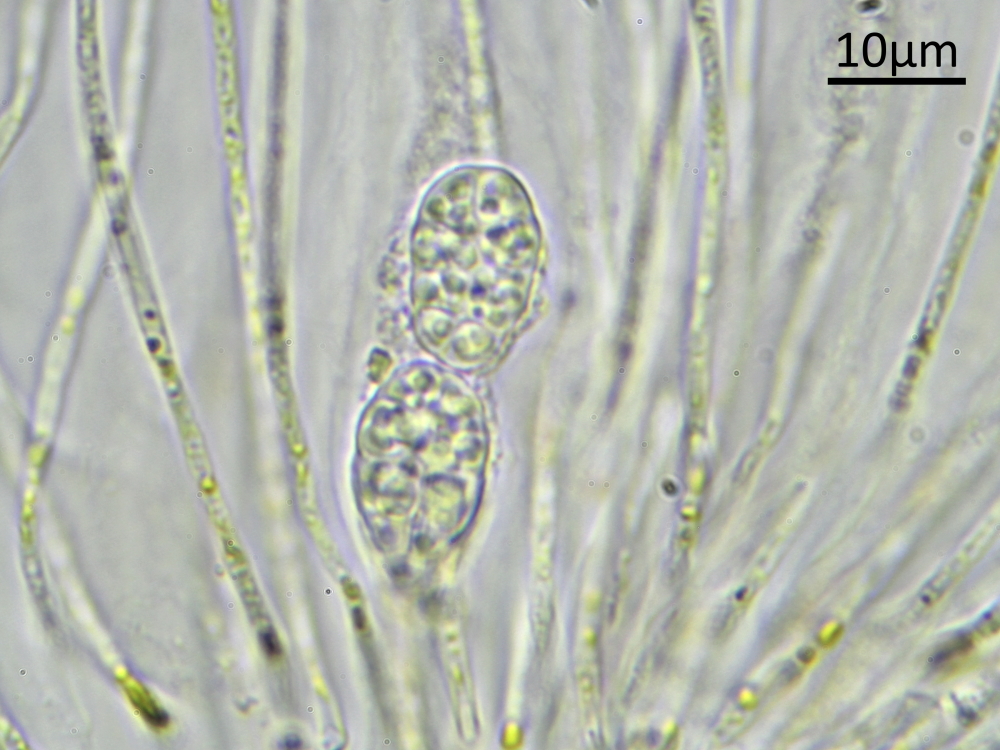 Gyalecta truncigena (door Henk-Jan van der Kolk (leg. Tom Schrier))